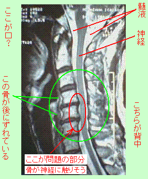 MRI-1.GIF