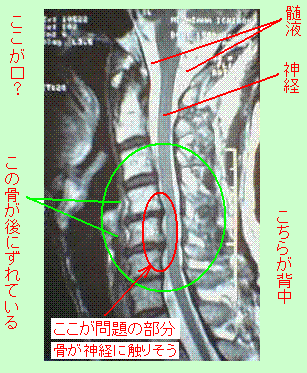 MRI-1.GIF